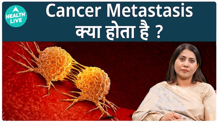 कैंसर मेटास्टेसिस क्या होता है?  |  स्वास्थ्य लाइव