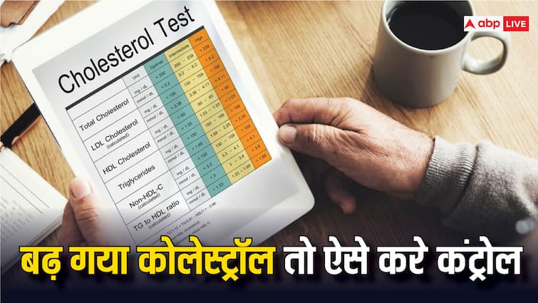 health tips high cholesterol reduce best remedies in hindi Cholesterol: जल्द ही कंट्रोल में आ जाएगा बढ़ा हुआ कोलेस्ट्रॉल, बस आज से ही शुरू कर दें 5 काम