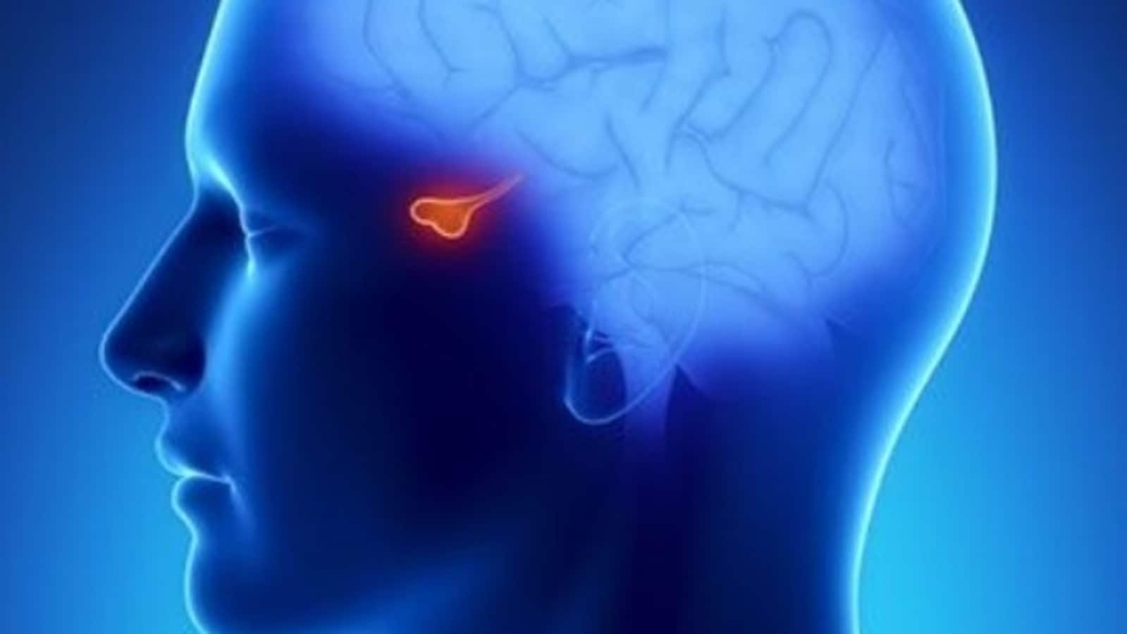 पिट्यूटरी ट्यूमर के कारण होने वाले हार्मोनल व्यवधान: एंडोक्राइनोलॉजिस्ट ने जानकारी साझा की