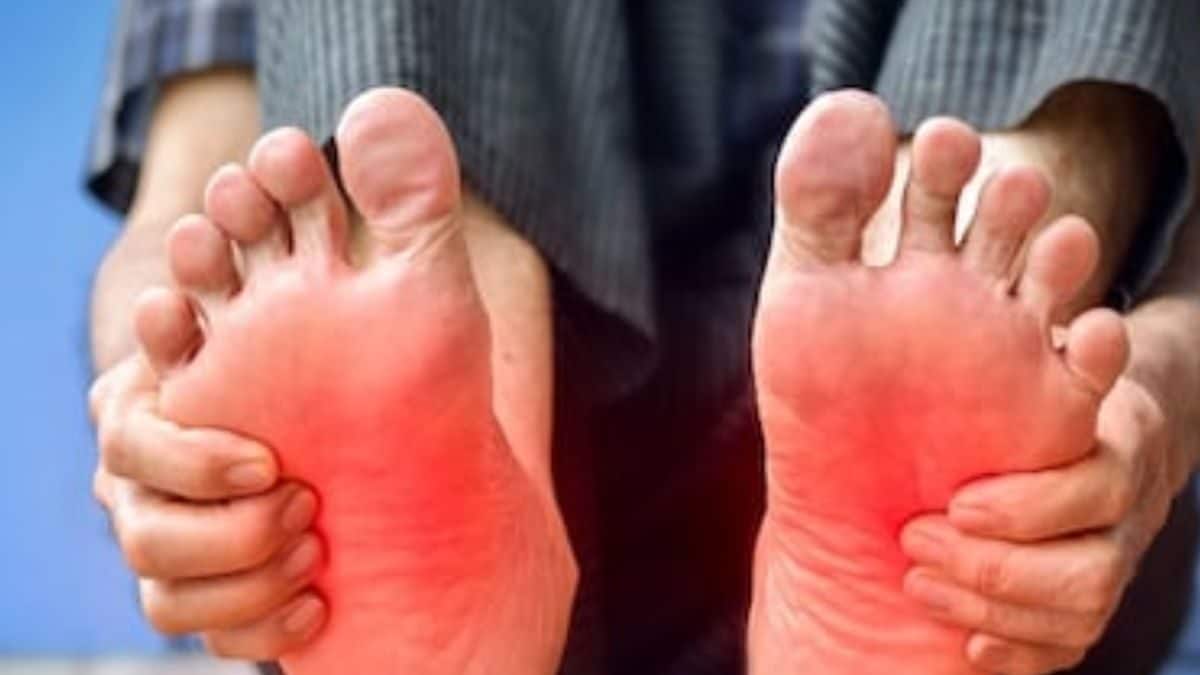 विटामिन की कमी से लेकर किडनी में संक्रमण तक, पैरों में जलन के पीछे ये हैं कारण - News18 Hindi